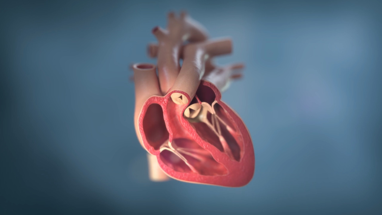 Video Link: Understanding Hypertrophic Cardiomyopathy